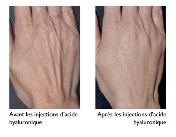 Soins et beauté des mains..@ DR