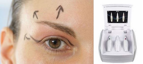 PLEX’Râ se présente sous la forme d’un gros stylo que le médecin esthétique tient en main avec à son extrémité une très fine tige de métal qui sert d’applicateur. @ DR PLEX’Râ se présente sous la forme d’un gros stylo que le médecin esthétique tient en main avec à son extrémité une très fine tige de métal qui sert d’applicateur. @ DR