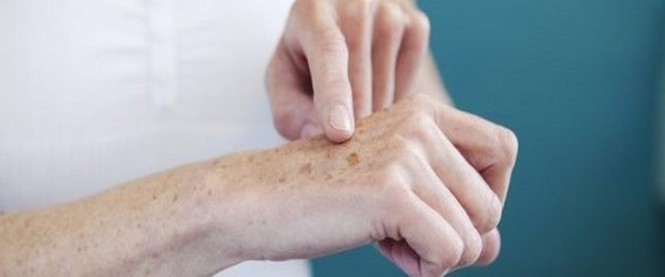 pallier le vieillissement des mains par de simples soins pour commencer, et plus tard, par des traitements rapides, indolores et surtout très efficaces.  @ DR