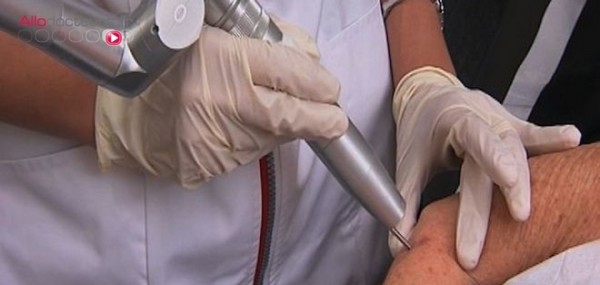 supprimer ou estomper les taches brunes au laser; @ DR supprimer ou estomper les taches brunes au laser; @ DR