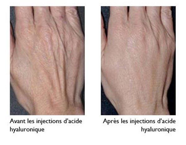 Soins et beauté des mains..@ DR Soins et beauté des mains..@ DR
